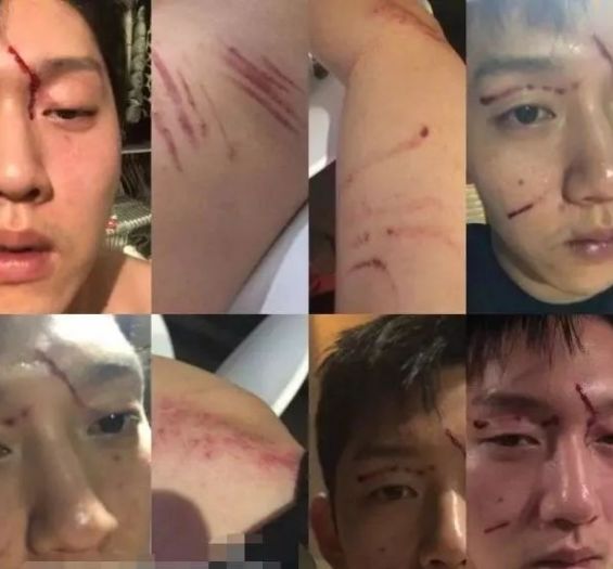 向天真的女生投降 产品主图